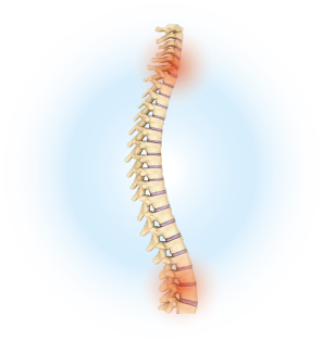 Chirurgia ortopedica colonna vertebrale - dolore